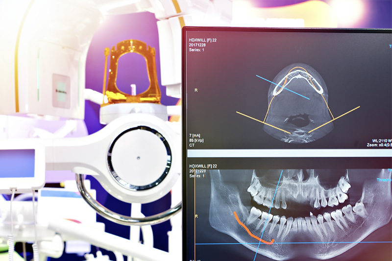 Digital X-Rays in Hurst