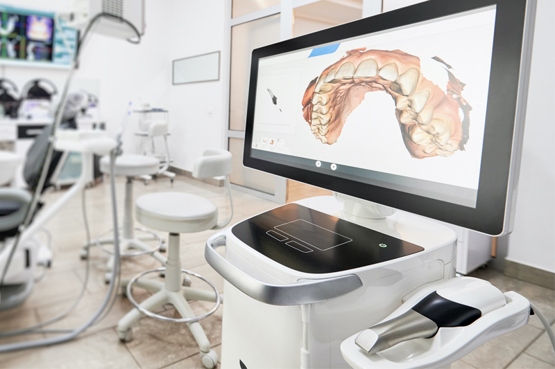 Intra-Oral Scanner in Hurst